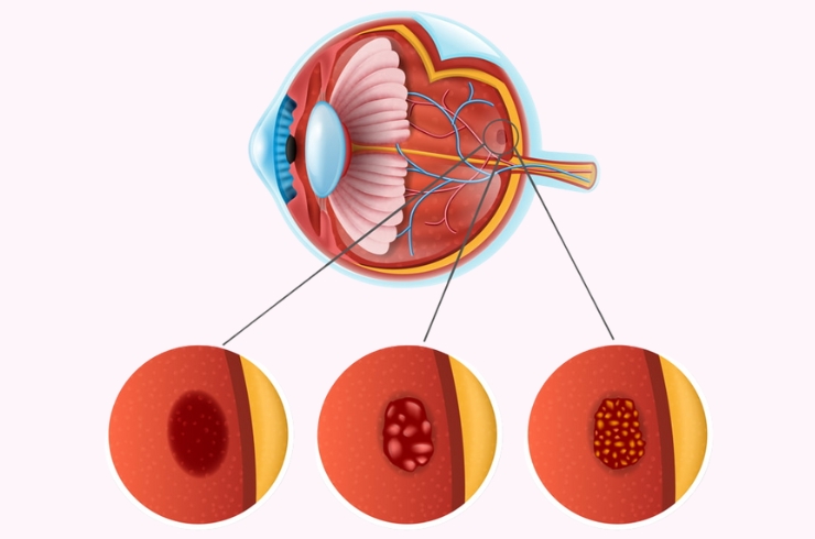 Sanjivani Eye Hospital