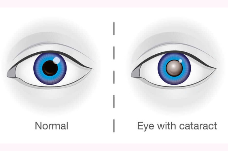 Sanjivani Eye Hospital