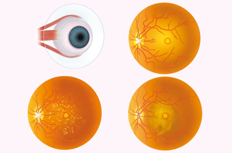 Sanjivani Eye Hospital