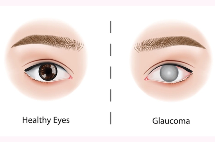 Sanjivani Eye Hospital