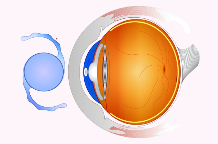 Sanjivani Eye Hospital