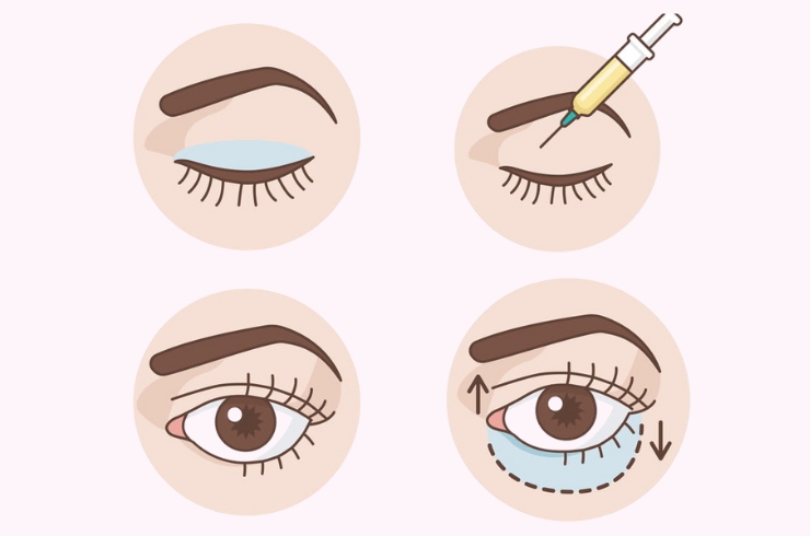 Sanjivani Eye Hospital