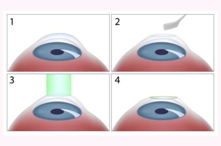 Sanjivani Eye Hospital