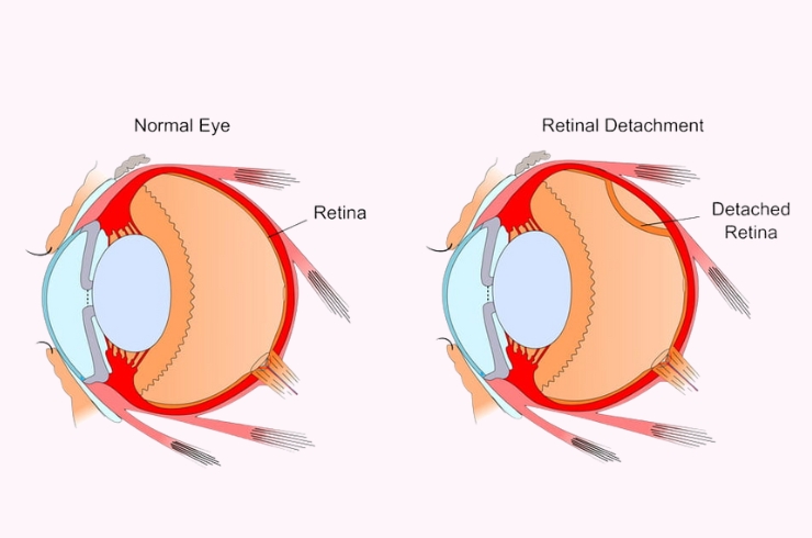 Sanjivani Eye Hospital
