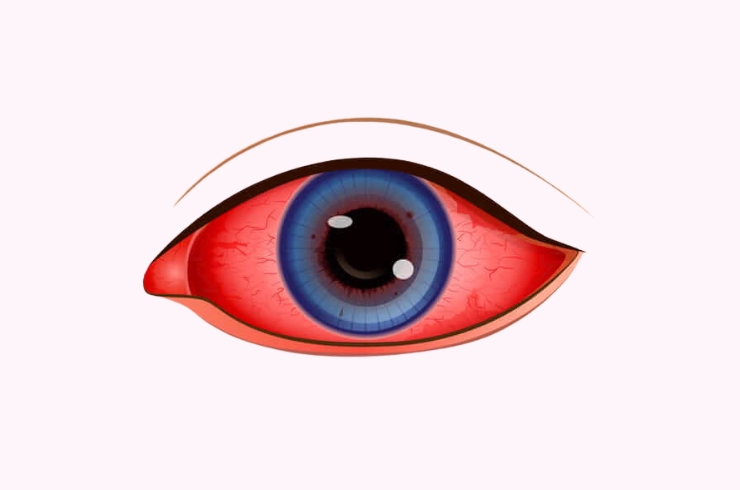 Sanjivani Eye Hospital